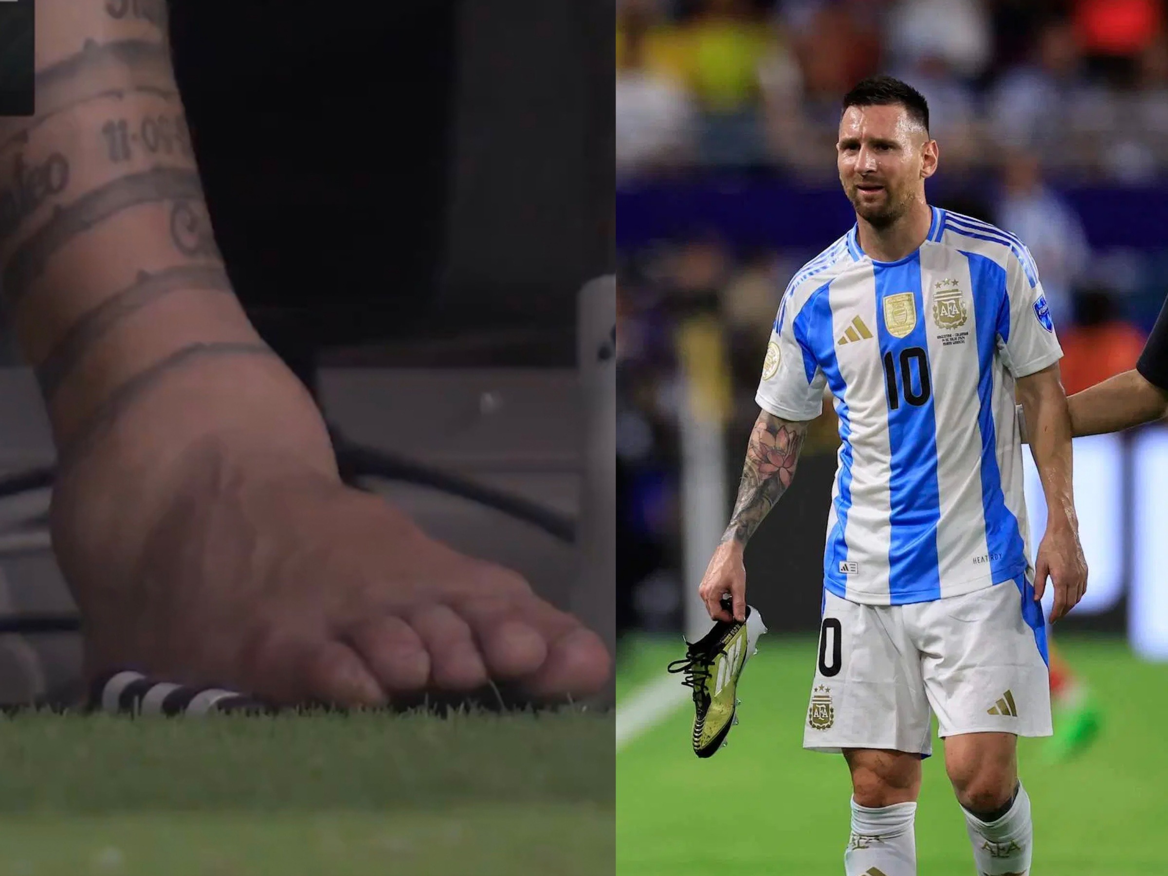 Lionel Messi Gives Fitness Update After Emotional Copa America 2024 Final